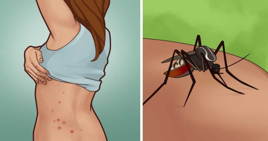 Des façons faciles de se débarrasser des moustiques sans utiliser de DEET ou de lotion à la calamine